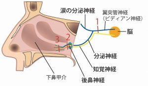 図２：後鼻神経（翼突管神経後鼻枝）の切断方法。当院では図の3の部位で後鼻神経を切断しています。