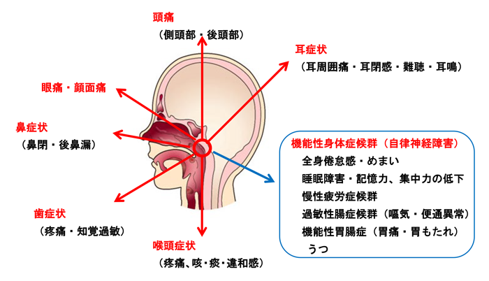 図２：上咽頭炎の症状は多彩である。